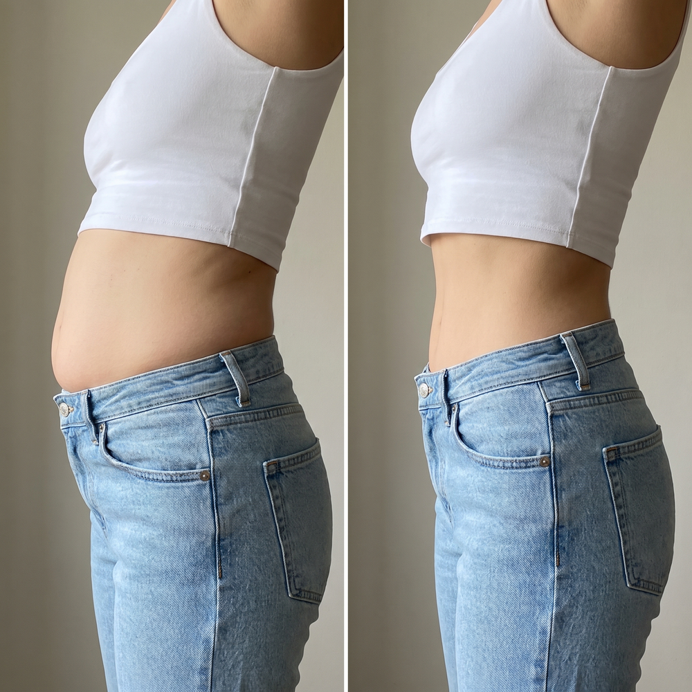 Illustration of possible results using a model — bloating at the waistband before and after